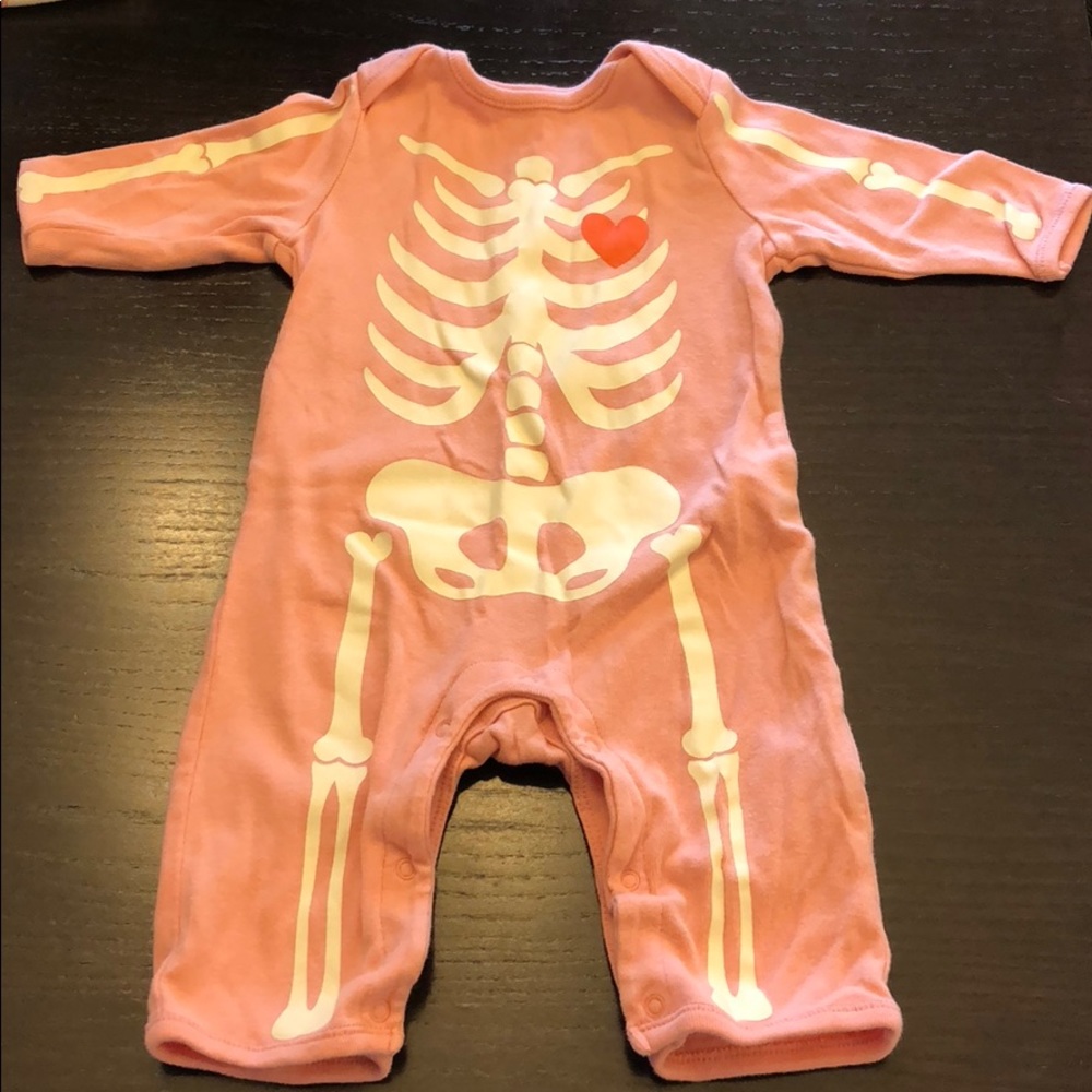 Skeleton Onesie